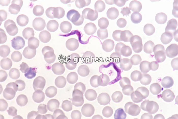 Trypanosomes dans le sang humain - Trypanosoma gambiense x200 - gryphea.org